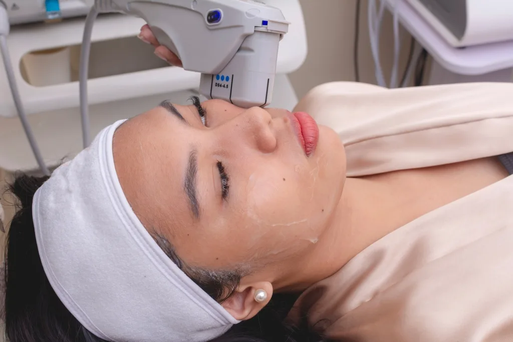 HIFU face lift