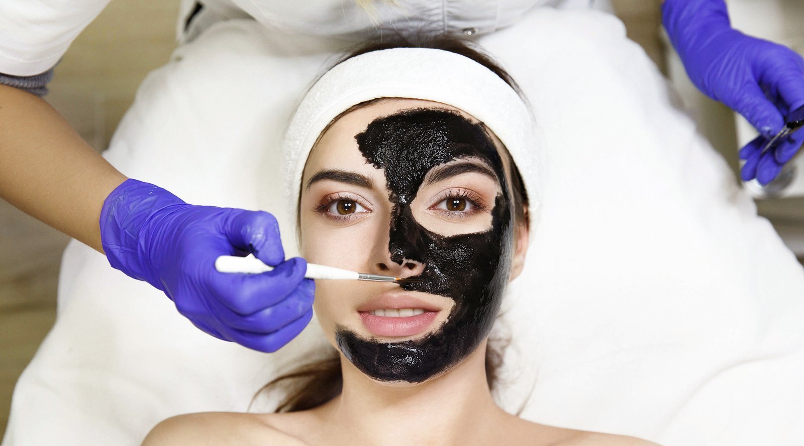 Carbon peel