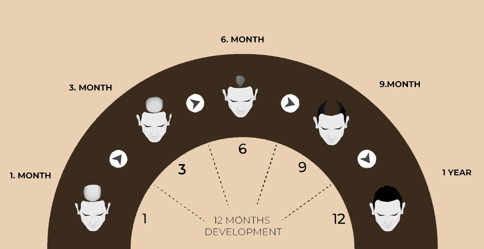 Hair Transplant Recovery Timeline